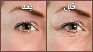 أعيدي شبابك مرة إخرى.. كولاجين القهوة السحري هيشيل التجاعيد من بشرتك بسرعة خيالية