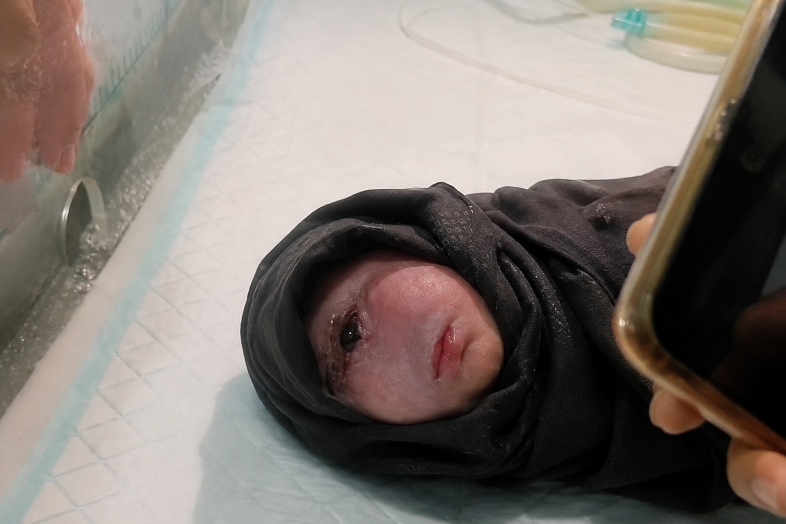 فيديو لطفل حديث الولادة بملامح نادرة يثير جدلًا واسعًا على مواقع التواصل.. والحقيقة ما زالت غير مؤكدة