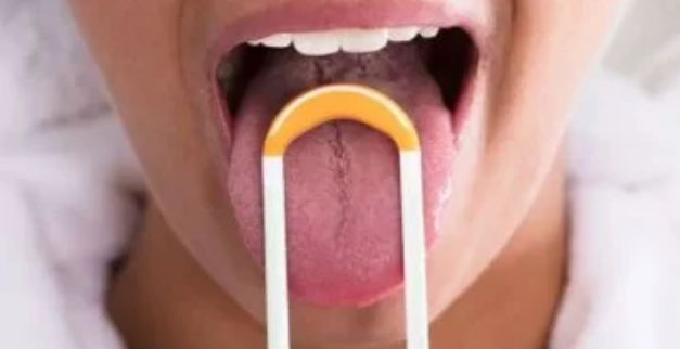 بكتيريا اللسان والقدرات العقلية.. ماذا كشفت دراسة حديثة؟